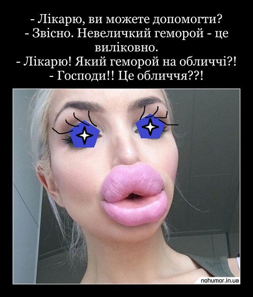- Лікарю, ви можете допомогти? - Звісно. Невеличкий геморой - це виліковно. - Лікарю! Який геморой на обличчі?! - Господи!! Це обличчя??!